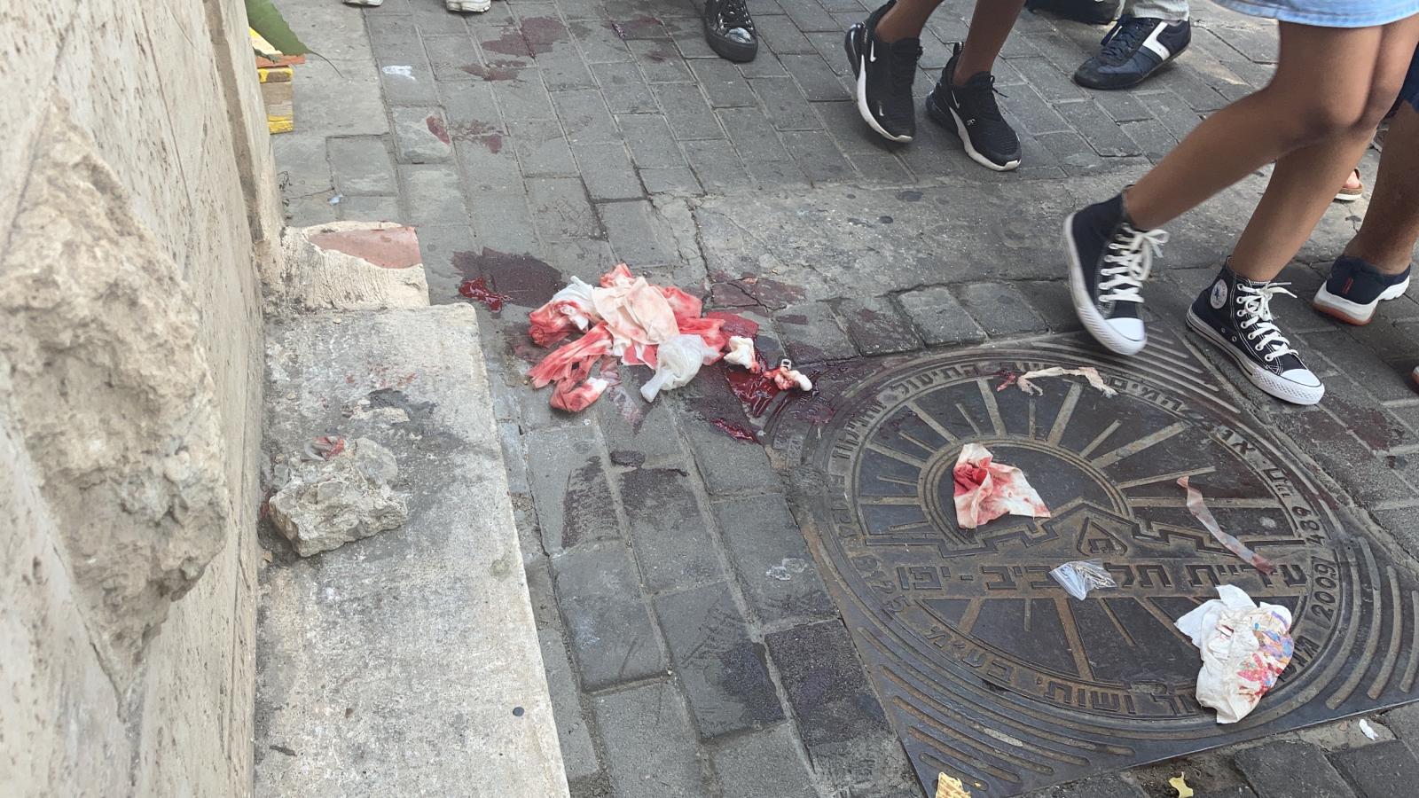 WhatsApp Image 2020-09-04 at 1.33.09 PM.jpeg.jpeg